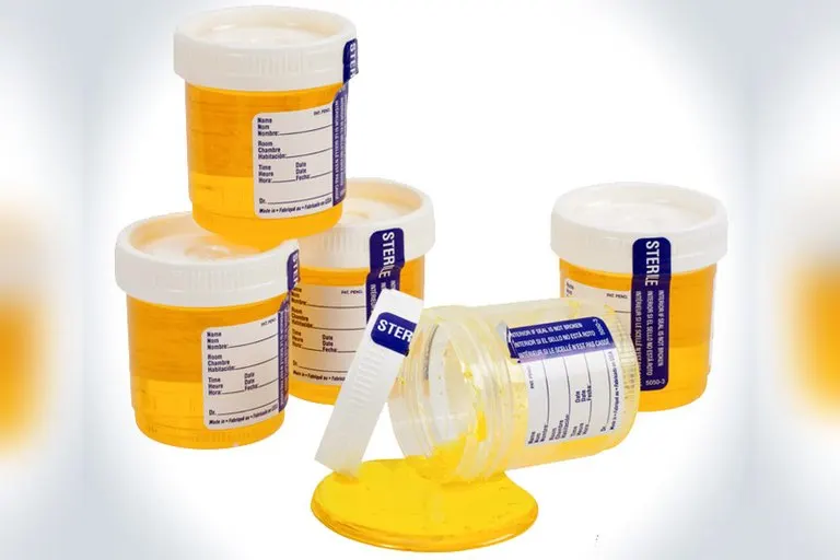 Tower of Sour Liquid Candy Urine Samples