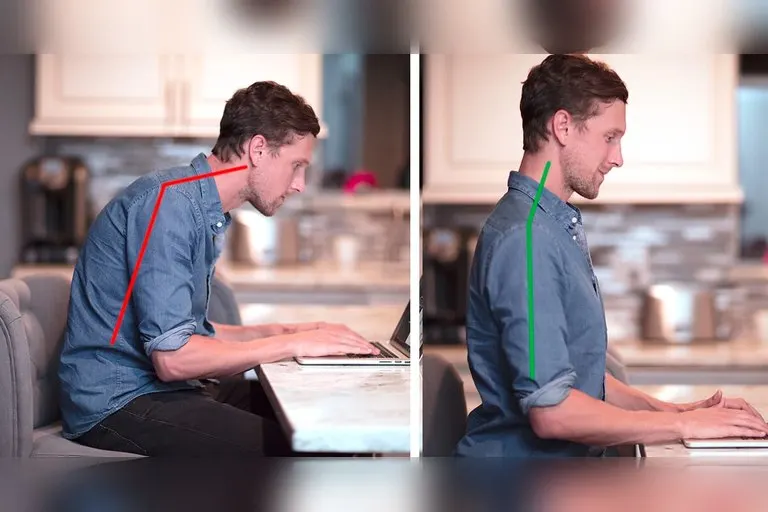 FitNeck Posture Exerciser